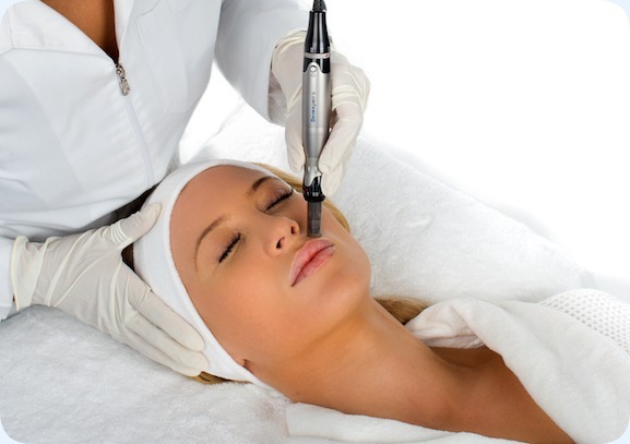 Microneedling